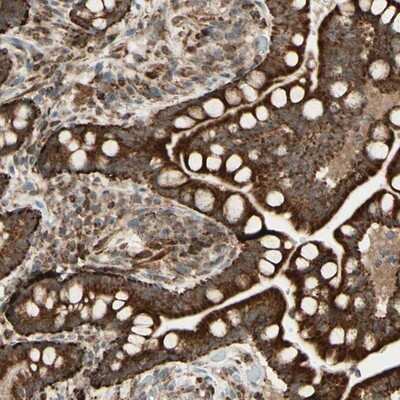 Immunohistochemistry-Paraffin DHRS3 Antibody