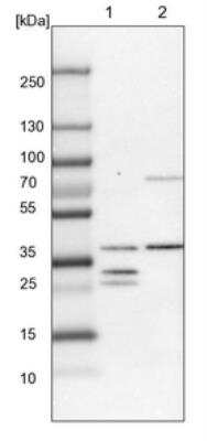 Western Blot DHRS3 Antibody