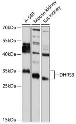 Western Blot DHRS3 Antibody - BSA Free