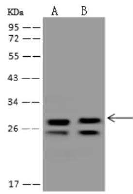 Western Blot DHRS3 Antibody - BSA Free