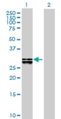 Western Blot: DHRS4 Antibody [H00010901-B01P] - Analysis of DHRS4 expression in transfected 293T cell line by DHRS4 polyclonal antibody.  Lane 1: DHRS4 transfected lysate(30.58 KDa). Lane 2: Non-transfected lysate.