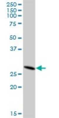 Western Blot: DHRS4L2 Antibody [H00317749-B01P] - Analysis of DHRS4L2 expression in human kidney.