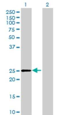 Western Blot: DHRS4L2 Antibody [H00317749-B01P] - Analysis of DHRS4L2 expression in transfected 293T cell line by DHRS4L2 polyclonal antibody.  Lane 1: DHRS4L2 transfected lysate(25.3 KDa). Lane 2: Non-transfected lysate.