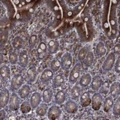 Immunohistochemistry-Paraffin: DHRS7 Antibody [NBP3-17357] - Staining of human small intestine shows strong cytoplasmic positivity in glandular cells.
