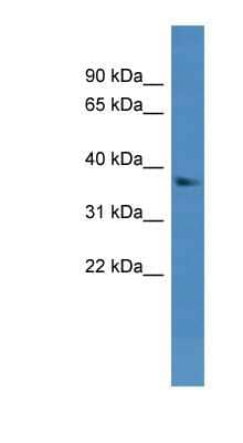 Western Blot: DHRS7 Antibody [NBP1-68913] - Titration: 0.2-1 ug/ml, Positive Control: Mouse Liver.