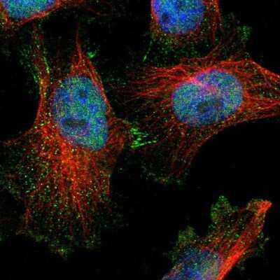 Immunocytochemistry/Immunofluorescence: DHRS7B Antibody [NBP1-85648] - Immunofluorescent staining of human cell line U-251 MG shows localization to nucleoplasm, cytosol & cell junctions. Antibody staining is shown in green. 