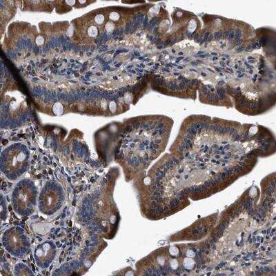 Immunohistochemistry-Paraffin: DHRS7B Antibody [NBP1-85648] - Staining of human duodenum shows cytoplasmic positivity in glandular cells.