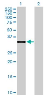 Western Blot: DHRS7B Antibody [H00025979-B01P] - Analysis of DHRS7B expression in transfected 293T cell line by DHRS7B polyclonal antibody.  Lane 1: DHRS7B transfected lysate(35.75 KDa). Lane 2: Non-transfected lysate.