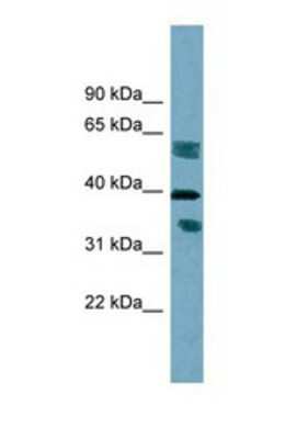 Western Blot: DHRS7B Antibody [NBP1-69584] - This Anti-DHRS7B antibody was used in Western Blot of HT1080     tissue lysate at a concentration of 1ug/ml.