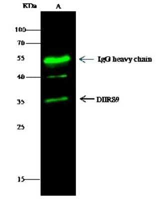 Immunoprecipitation: DHRS9 Antibody [NBP2-97017] - DHRS9 was immunoprecipitated using: Lane A: 0.5 mg THP-1 Whole Cell Lysate. 1 ul anti-DHRS9 rabbit polyclonal antibody and 15 ul of 50 % Protein G agarose. Primary antibody: Anti-DHRS9 rabbit polyclonal antibody, at 1:500 dilution. Secondary antibody: Dylight 800-labeled antibody to rabbit IgG (H+L), at 1:5000 dilution. Developed using the Odyssey technique. Performed under reducing conditions. Predicted band size: 35 kDa. Observed band size: 35 kDa