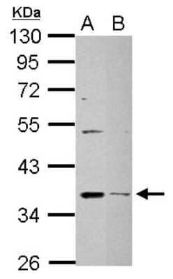 Western Blot: DHRS9 Antibody [NBP2-16160] - Sample (30 ug of whole cell lysate) A: NT2D1 B: SK-N-SH 10% SDS PAGE gel, diluted at 1:1000.