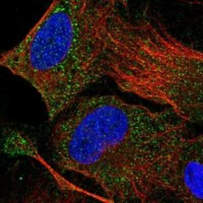 Immunocytochemistry/Immunofluorescence: DHRSX Antibody [NBP3-17830] - Staining of human cell line U-2 OS shows localization to cytosol.