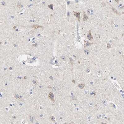 Immunohistochemistry-Paraffin DHRSX Antibody - BSA Free