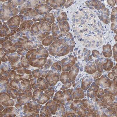 Immunohistochemistry-Paraffin DHRSX Antibody - BSA Free