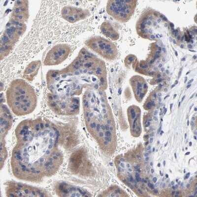 Immunohistochemistry-Paraffin: DHRSX Antibody [NBP1-85219] - Staining of human placenta shows moderate cytoplasmic positivity in trophoblastic cells.