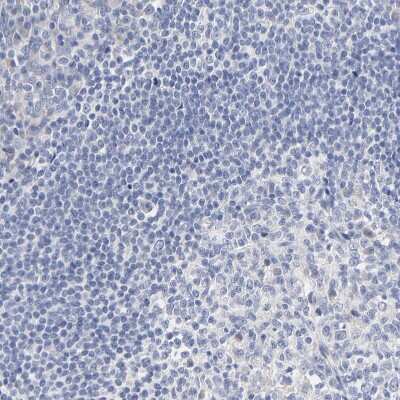 Immunohistochemistry-Paraffin: DHRSX Antibody [NBP1-85219] - Staining of human tonsil shows no positivity in non-germinal center cells as expected.