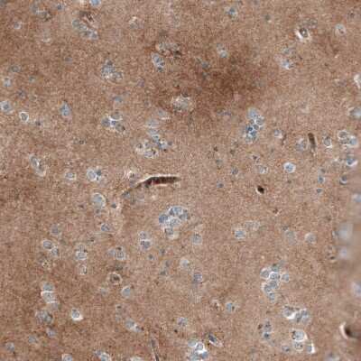 Immunohistochemistry-Paraffin: DHRSX Antibody [NBP1-85219] - Staining of human Cerebral cortex shows moderate cytoplasmic positivity in neuropil.