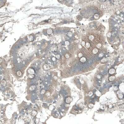 Immunohistochemistry-Paraffin: DHRSX Antibody [NBP1-85219] - Staining of human Duodenum shows weak cytoplasmic positivity in glandular cells.