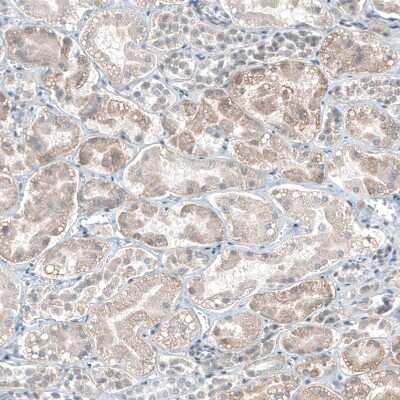 Immunohistochemistry-Paraffin: DHRSX Antibody [NBP1-85219] - Staining of human Kidney shows moderate cytoplasmic positivity in cells in tubules.