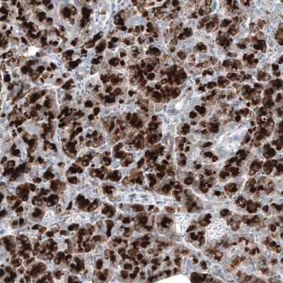 Immunohistochemistry-Paraffin: DHRSX Antibody [NBP1-85219] - Staining of human Pancreas shows strong cytoplasmic positivity in exocrine glandular cells.