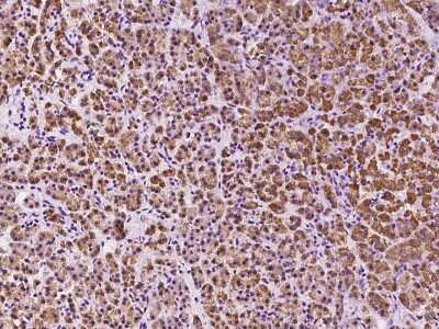 Immunohistochemistry-Paraffin: DHRSX Antibody [NBP2-97560] - Immunochemical staining of human DHRSX in human pancreas with rabbit polyclonal antibody at 1:200 dilution, formalin-fixed paraffin embedded sections.
