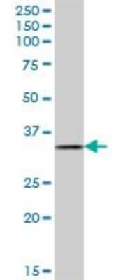 Western Blot: DHRSX Antibody [H00207063-B01P] - Analysis of DHRSX expression in human liver.