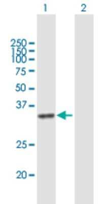Western Blot: DHRSX Antibody [H00207063-B01P] - Analysis of DHRSX expression in transfected 293T cell line by DHRSX polyclonal antibody.  Lane 1: DHRSX transfected lysate(36.3 KDa). Lane 2: Non-transfected lysate.