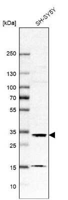 Western Blot: DHRSX Antibody [NBP1-85219] - Analysis in human cell line SH-SY5Y.
