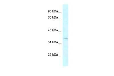 Western Blot: DHRSX Antibody [NBP2-87269] - WB Suggested Anti-DHRSX Antibody. Titration: 1.0 ug/ml. Positive Control: THP-1 Whole Cell