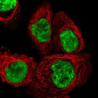 Immunocytochemistry/Immunofluorescence: DHX15 Antibody [NBP2-13919] - Staining of human cell line A-431 shows localization to nuclear speckles. Antibody staining is shown in green.