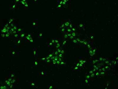 Immunocytochemistry/Immunofluorescence: DHX15 Antibody [NBP2-97611] - Immunofluorescence staining of DHX15 in A431 cells. Cells were fixed with 4% PFA, permeabilzed with 0.1% Triton X-100 in PBS, blocked with 10% serum, and incubated with rabbit anti-Human DHX15 polyclonal antibody (dilution ratio 1:200) at 4C overnight. Then cells were stained with the Alexa Fluor(R)488-conjugated Goat Anti-rabbit IgG secondary antibody (green). Positive staining was localized to Nucleus .