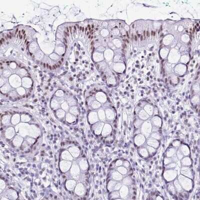 Immunohistochemistry-Paraffin: DHX15 Antibody [NBP2-13919] - Staining of human rectum shows moderate  nuclear positivity in glandular cells.