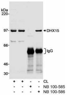 Western Blot: DHX15 Antibody [NB100-585] - Detection of Human DHX15 on HeLa whole cell lysate using NB100-585. Successful IP of DHX15 was accomplished using NB100-586 at 1 mcg/mg lysate.