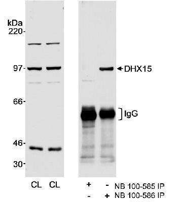 <b>Biological Strategies Validation. </b>Western Blot: DHX15 Antibody [NB100-586] - Detection of Human DHX15 on HeLa whole cell lysate using NB100-586. Immunoprecipitated DHX15 was blotted using NB100-585 at 0.1 mcg/ml. NB100-585 was also used unsuccessfully for IP.