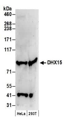 Western Blot: DHX15 Antibody [NB100-586] - Detection of Human DHX15 by Western Blot. Samples: Whole cell lysate (50 ug) from HeLa and 293T cells prepared using NETN lysis buffer. Antibody: Affinity purified rabbit anti-DHX15 antibody NB100-586 used for WB at 0.066 ug/ml. Detection: Chemiluminescence with an exposure time of 3 minutes.