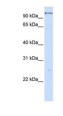 Western Blot: DHX15 Antibody [NBP1-57204] - 293T cells lysate, concentration 0.2-1 ug/ml.