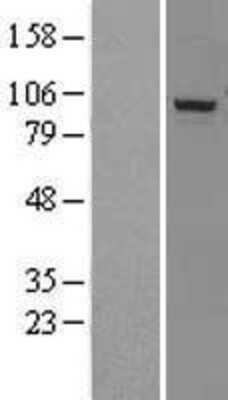 Western Blot: DHX15 Overexpression Lysate (Adult Normal) [NBL1-09876] Left-Empty vector transfected control cell lysate (HEK293 cell lysate); Right -Over-expression Lysate for DHX15.