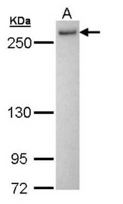 Western Blot: DHX16 Antibody [NBP1-31067] - Sample (30 ug of whole cell lysate) A: Raji 5% SDS PAGE, antibody diluted at 1:500.