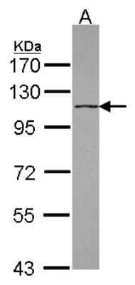 Western Blot: DHX16 Antibody [NBP2-16161] - Sample (30 ug of whole cell lysate) A: Raji 7. 5% SDS PAGE gel, diluted at 1:1000.