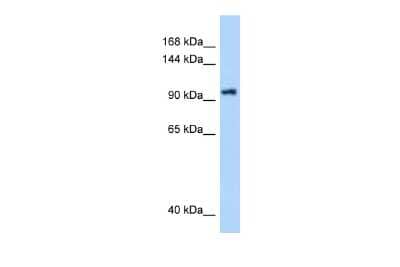 Western Blot: DHX16 Antibody [NBP2-87270] - WB Suggested Anti-DHX16 Antibody. Titration: 0.25 ug/ml. Positive Control: PANC1 Whole Cell