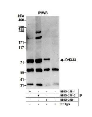 Immunoprecipitation: DHX33 Antibody [NB100-2581] - Detection of human DHX33 by western blot of immunoprecipitates. Samples: Whole cell lysate (0.5 or 1.0 mg per IP reaction; 20% of IP loaded) from HeLa cells prepared using NETN lysis buffer. Antibodies: Affinity purified rabbit anti-DHX33 antibody NB100-2581 (lot 2) used for IP at 6 ug per reaction. DHX33 was also immunoprecipitated by a previous lot of this antibody (lot 1) and rabbit anti-DHX33 antibody NB100-2580. For blotting immunoprecipitated DHX33, NB100-2581 was used at 1 ug/ml. Detection: Chemiluminescence with an exposure time of 3 minutes.