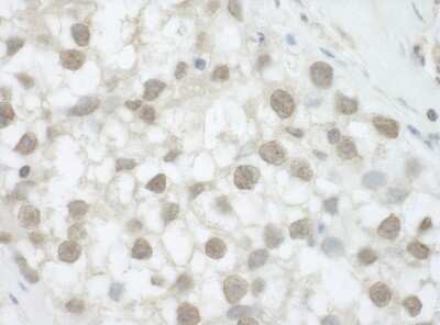 Immunohistochemistry: DHX36 Antibody [NB200-353] - Sample: FFPE section of human testicular seminoma. Antibody: Affinity purified rabbit anti-DHX36 used at a dilution of 1:1,000 (1ug/ml). Detection: DAB