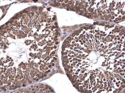 Immunohistochemistry-Paraffin: DHX36 Antibody [NBP3-12999] - DHX36 antibody detects DHX36 protein at cytoplasm in mouse testis by immunohistochemical analysis. Sample: Paraffin-embedded mouse testis. DHX36 antibody (NBP3-12999) diluted at 1:400. Antigen Retrieval: Citrate buffer, pH 6.0, 15 min