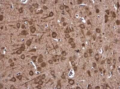 Immunohistochemistry-Paraffin: DHX36 Antibody [NBP3-12999] - DHX36 antibody detects DHX36 protein at cytoplasm in rat brain by immunohistochemical analysis. Sample: Paraffin-embedded rat brain. DHX36 antibody (NBP3-12999) diluted at 1:400. Antigen Retrieval: Citrate buffer, pH 6.0, 15 min