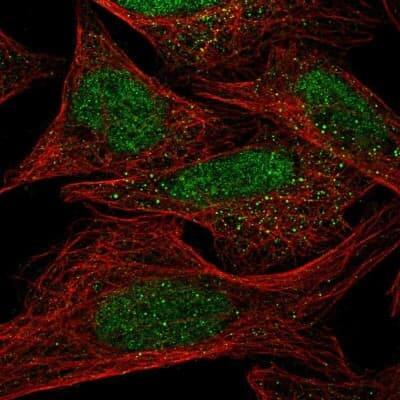 Immunocytochemistry/Immunofluorescence: DHX38 Antibody [NBP1-85269] - Staining of human cell line U-2 OS shows positivity in nucleus.