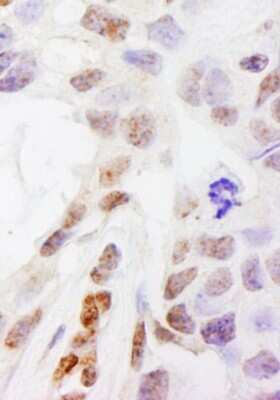 Immunohistochemistry DHX38 Antibody