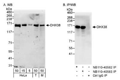 Western Blot DHX38 Antibody