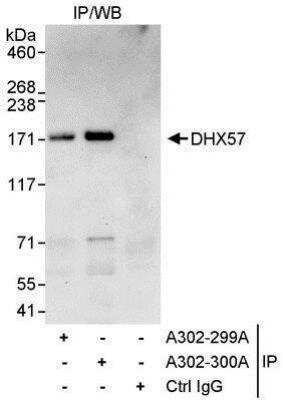 Immunoprecipitation: DHX57 Antibody [NBP1-28693] - Detection of Human DHX57 by Western Blot of Immunoprecipitates.  Samples: Whole cell lysate (1 mg for IP, 20% of IP loaded) from HeLa cells.   Antibodies: Affinity purified rabbit anti-DHX57 antibody NBP1-28693 used for IP at 10 mcg/mg lysate.  DHX57 was also immunoprecipitated by NBP1-28693, which recognizes a downstream epitope.  For blotting immunoprecipitated DHX57, NBP1-28738 was used at 0.4 mcg/ml, and the ReliaBLOT  Reagents and Procedures were incorporated.  Detection: Chemiluminescence with an exposure time of 30 seconds.
