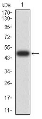 Western Blot DHX58 Antibody (6A6A3) - BSA Free