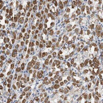 Immunohistochemistry: DHX58 Antibody [NBP1-85349] - Staining of human stomach shows cytoplasmic positivity in glandular cells.